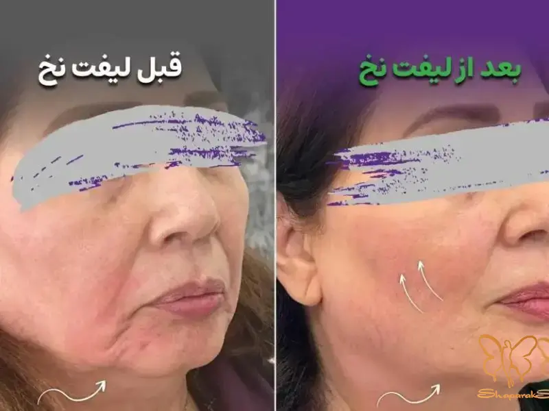 بهترین کلینیک تخصصی پوست و مو مشهد