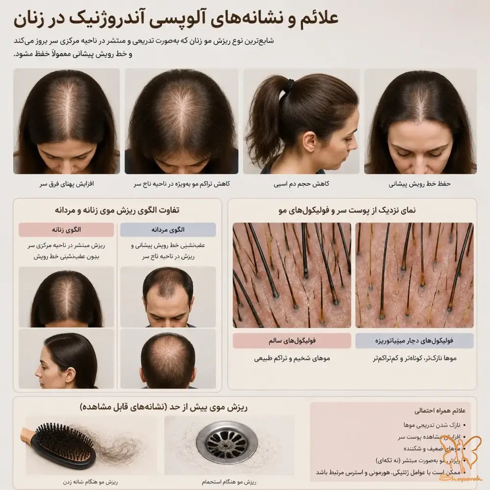 تفاوت الگوی ریزش موی زنانه و مردانه