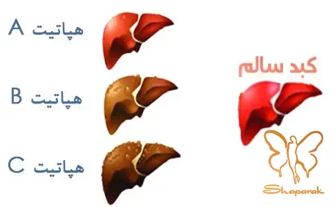 هپاتیت A و E کم خطرتر و قابل پیشگیری هپاتیت A و E کم خطرتر و قابل پیشگیری