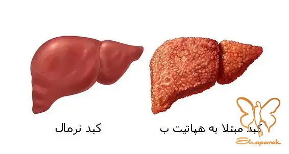 در کلینیک تخصصی پوست و مو شاپرک طلایی مشهد در کلینیک تخصصی پوست و مو شاپرک طلایی مشهد