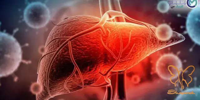 ماهیت بیماری ماهیت بیماری