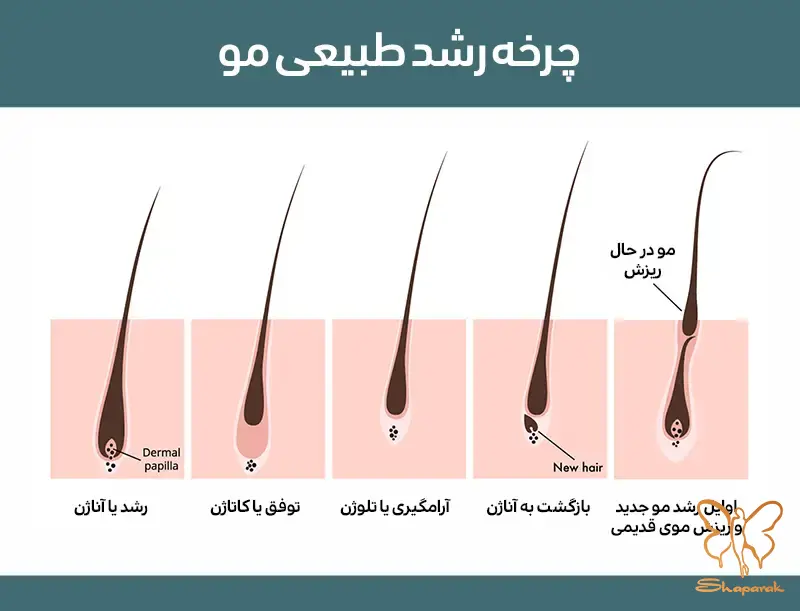 ریزش موها بعد از لیزر موهای زائد در مشهد چه زمانی و چگونه اتفاق میافتد