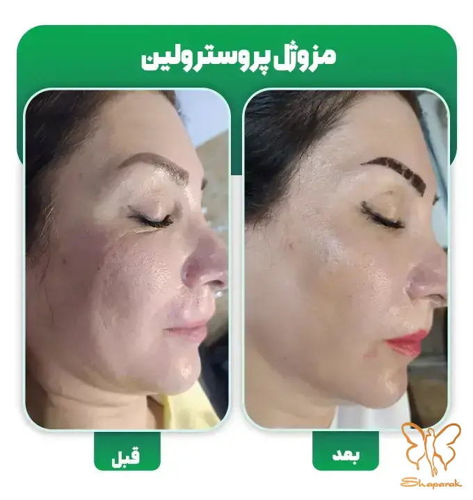  لکهای پوستی 
