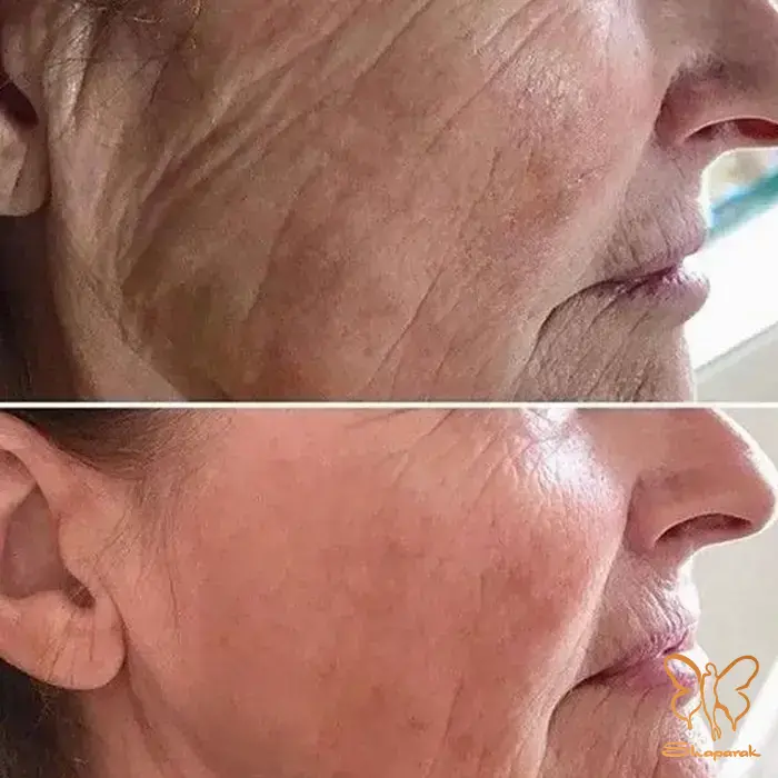 بهترین و معتبر ترین برندهای مزوژل بهترین و معتبر ترین برندهای مزوژل