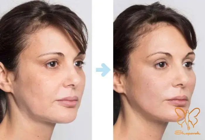 ملاحظات و نحوه انجام ملاحظات و نحوه انجام