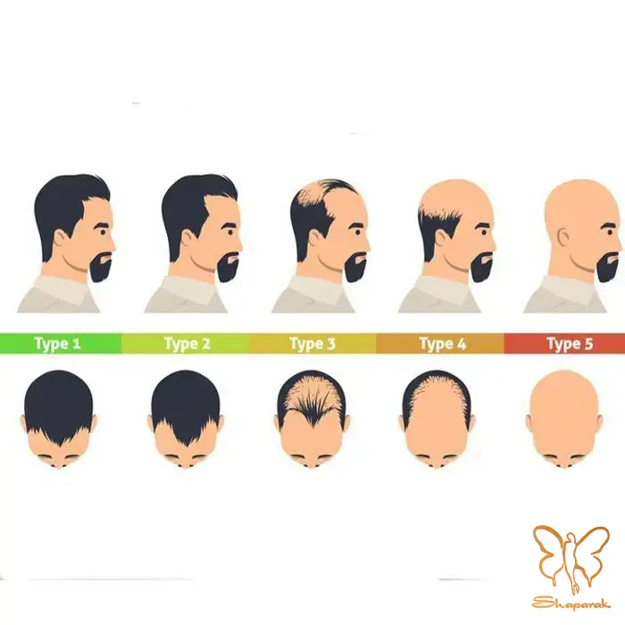 الگوی نوروود