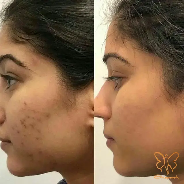 ملاحظات و نحوه انجام ملاحظات و نحوه انجام