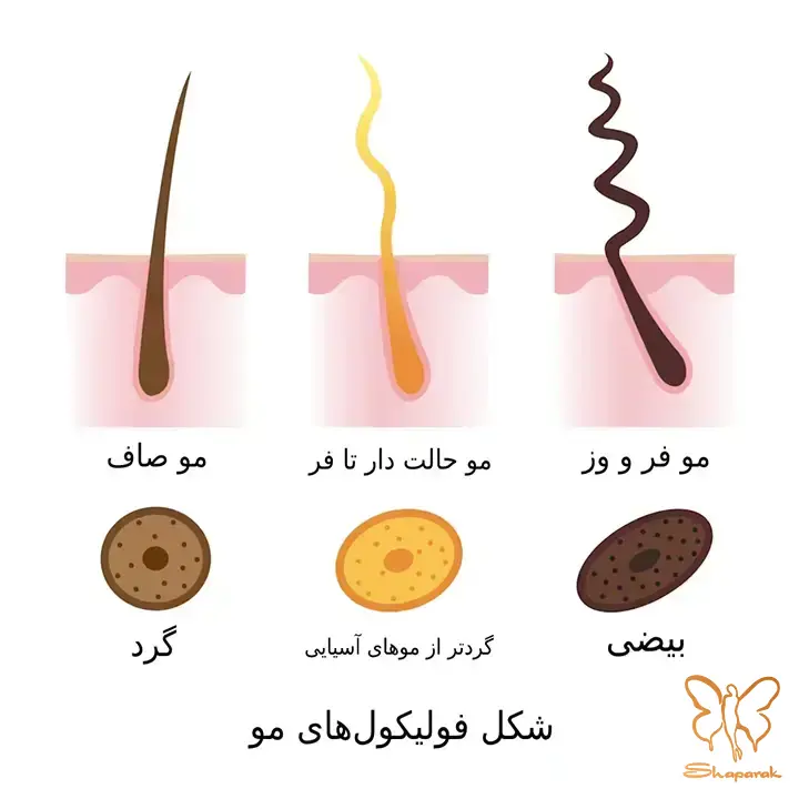 تاثیر نژاد بر ساختار مو چگونه است