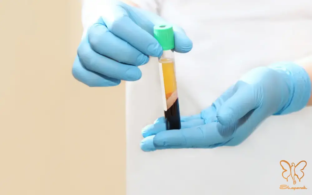 تزریق PRP ابرو در مشهد احیای ابروهای شما در کلینیک شاپرک طلایی