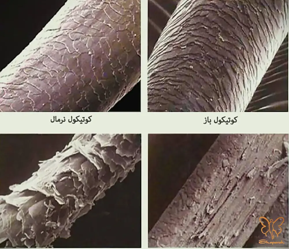 غلاف بیرونی ریشه مو 