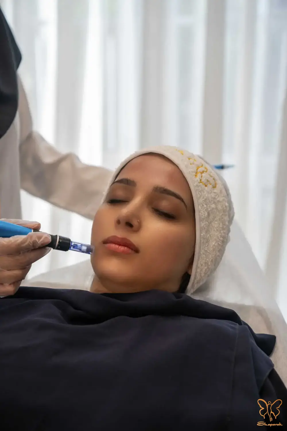میکرونیدلینگ در مشهد 