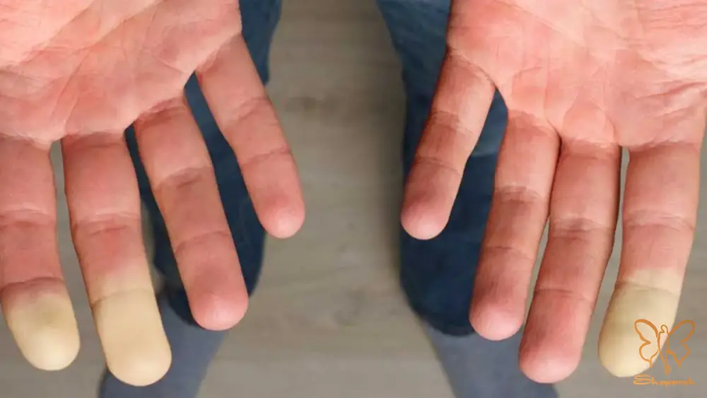 کلینیک تخصصی پوست و مو شاپرک طلایی مشهد کلینیک تخصصی پوست و مو شاپرک طلایی مشهد