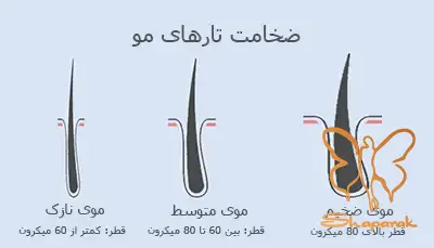 موی بدن دست پا سینه