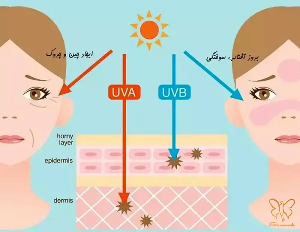 اشعه ماوراء بنفش UV