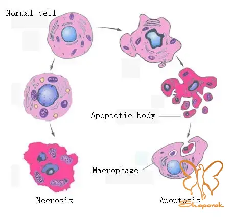  نکروز Necrosis