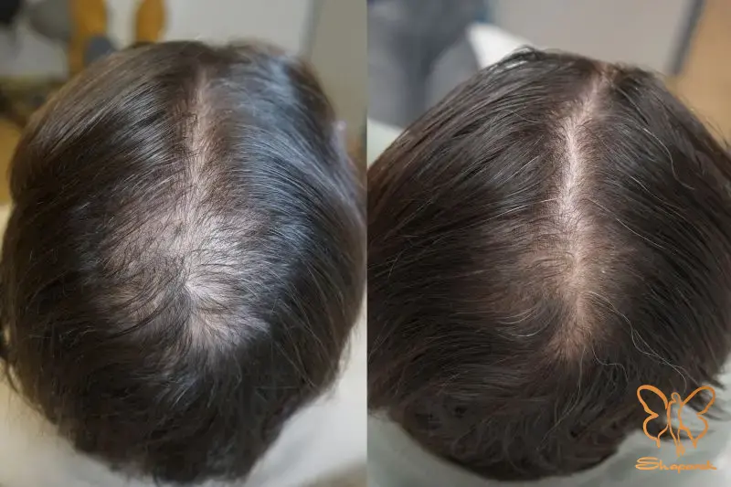 ایمنی بالا و حداقل عوارض