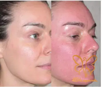 کلینیک تخصصی پوست و مو&nbsp;شاپرک طلایی مشهد