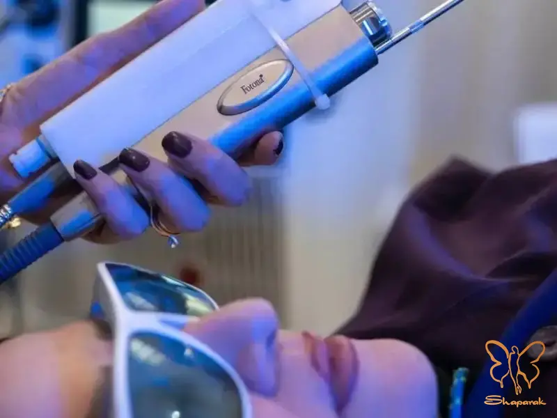 پی آر پی صورت در مشهد پی آر پی صورت در مشهد