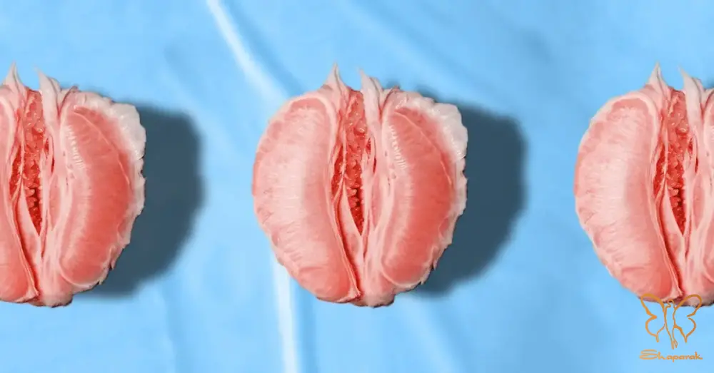 اصلاح عدم تقارن لابیاها