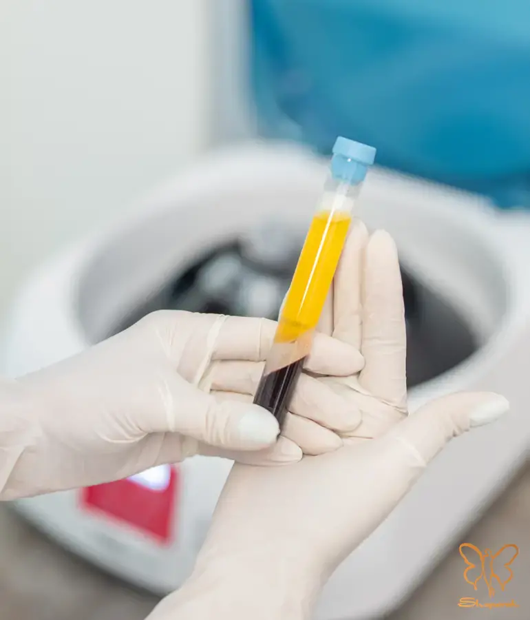 تزریق پی آر پی PRP در مشهد