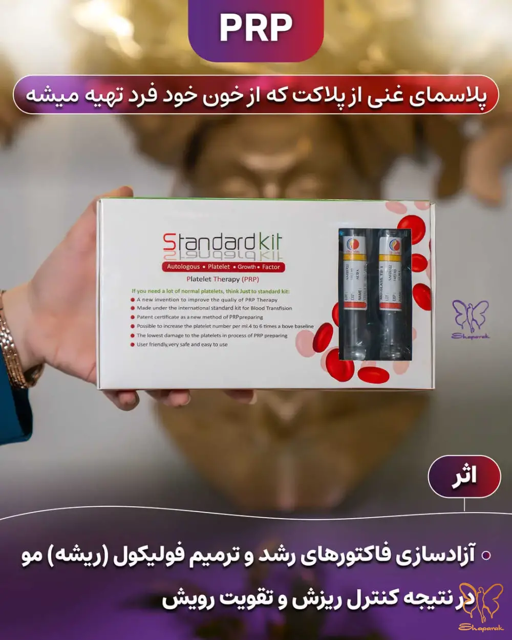 چرا PRP و PRF در کلینیک شاپرک طلایی انتخابی هوشمندانه است