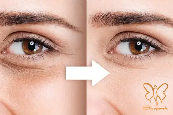 جالپرو یانگ آی در مشهد Jalupro Young Eye
