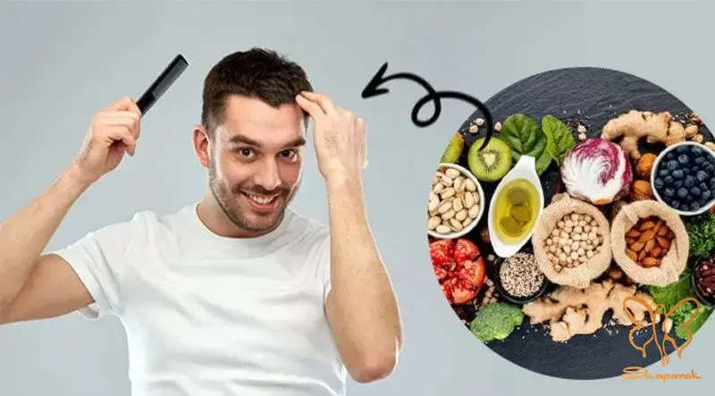 نقش تغذیه و کمبود ویتامینها در ریزش مو نقش تغذیه و کمبود ویتامینها در ریزش مو