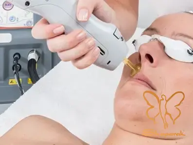 دستگاه لیزر موهای زائد کندلا در مشهد دستگاه لیزر موهای زائد کندلا در مشهد