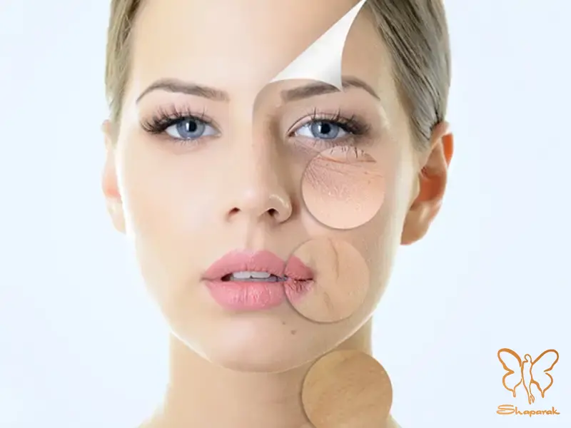 مراحل تزریق و انتظارات از مزوفیلر دیمونو در کلینیک شاپرک طلایی مشهد مراحل تزریق و انتظارات از مزوفیلر دیمونو در کلینیک شاپرک طلایی مشهد