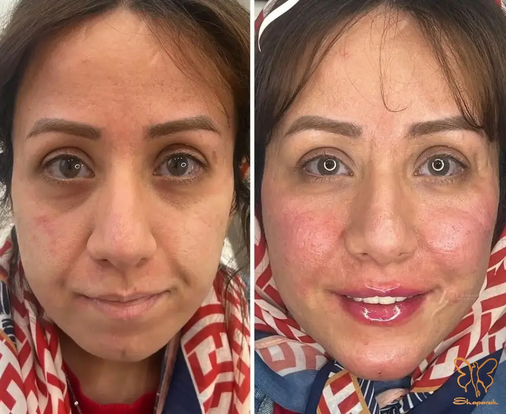 کلینیک تخصصی لیزر موهای زائد شاپرک طلایی مشهد کلینیک تخصصی لیزر موهای زائد شاپرک طلایی مشهد