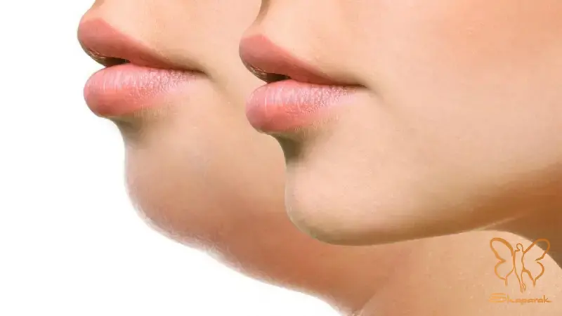 تجربه درخشان کادر پزشکی شاپرک طلایی در مشهد