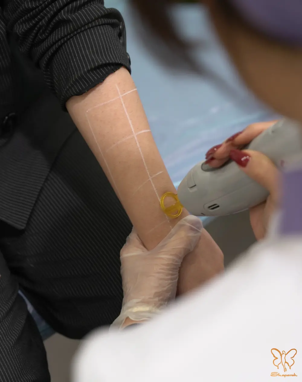 تفاوت درد در دستگاههای تماسی و غیرتماسی در مشهد تفاوت درد در دستگاههای تماسی و غیرتماسی در مشهد