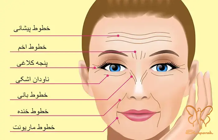  آراف فرکشنال صورت