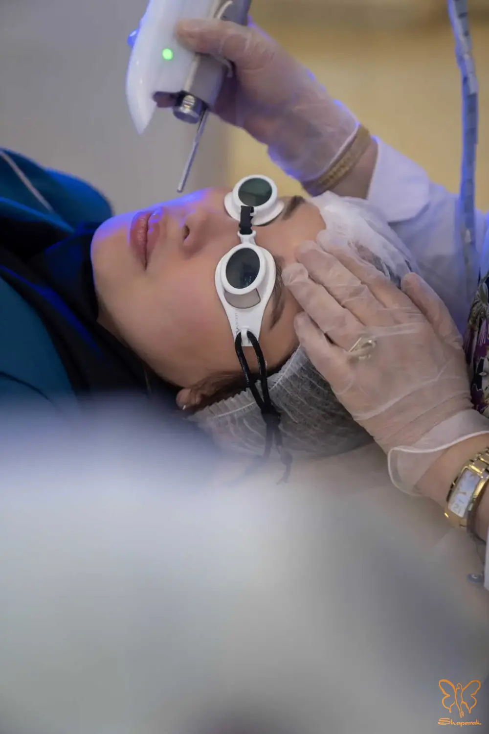 میکرونیدلینگ در مشهد میکرونیدلینگ در مشهد