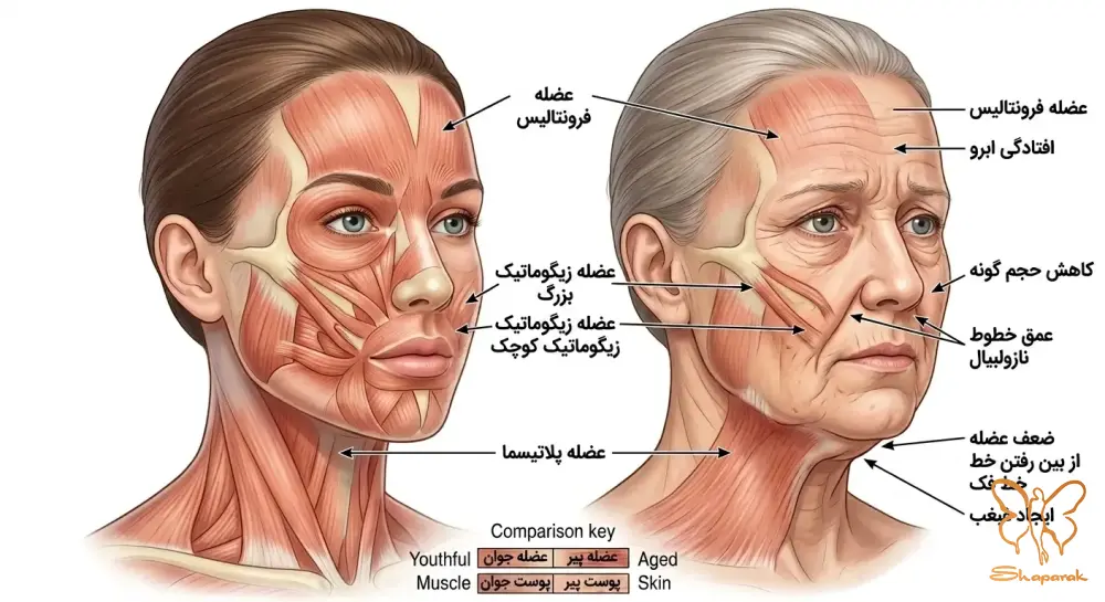 عضله پلاتیسما Platysma