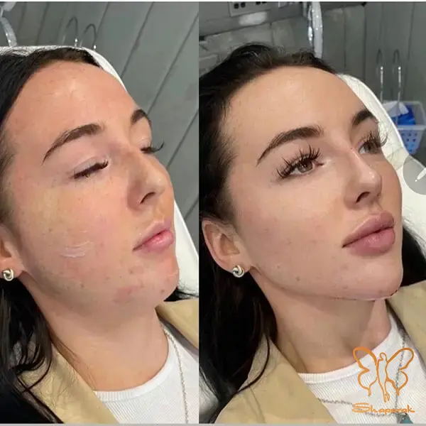 برند لونافیل Lunaphil برند لونافیل Lunaphil