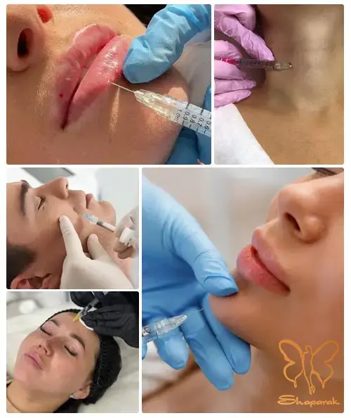 کلینیک تخصصی لیزر موهای زائد شاپرک طلایی مشهد کلینیک تخصصی لیزر موهای زائد شاپرک طلایی مشهد