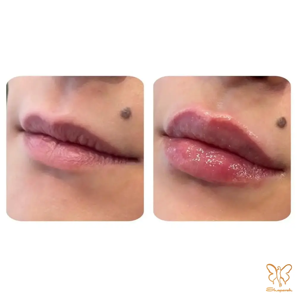 جدول مقایسه تخصصی ژل ها آیدیا در برابر آلیاکسین