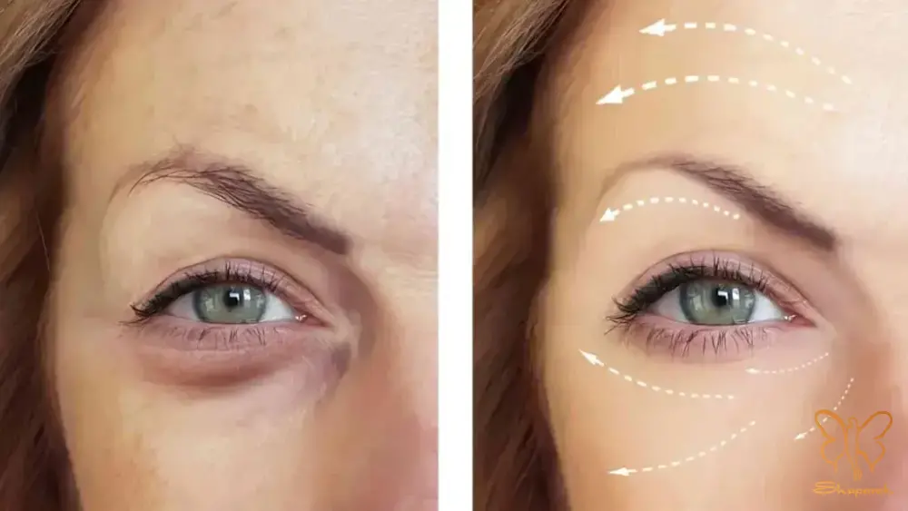 جالپرو یانگ آی در مشهد Jalupro Young Eye