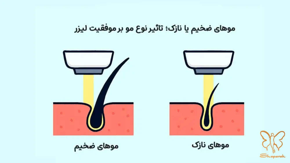 عوامل مؤثر بر ضخامت مو