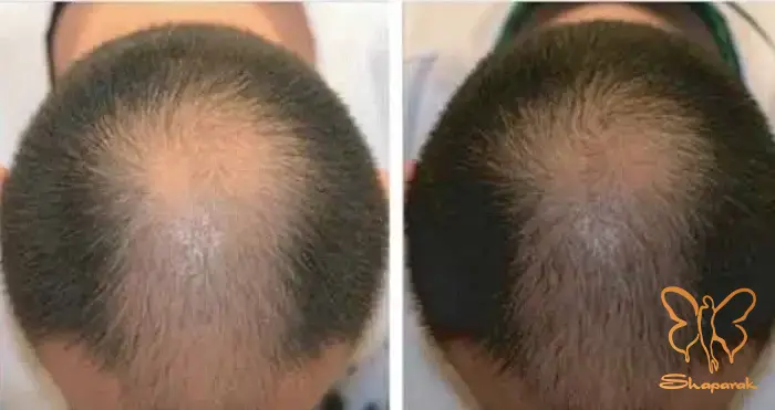  ویتامین های لازم پوست و مو