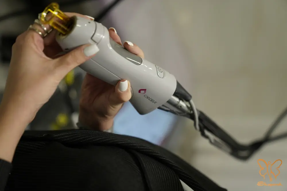 درمان قطعی موهای زیر پوستی