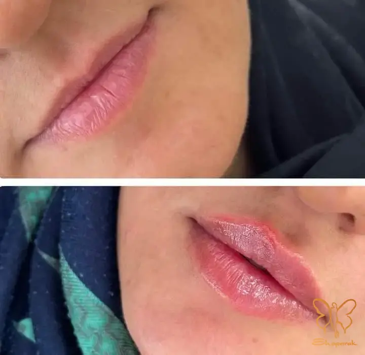 کلینیک&nbsp; تخصصی پوست و مو مشهد&nbsp;