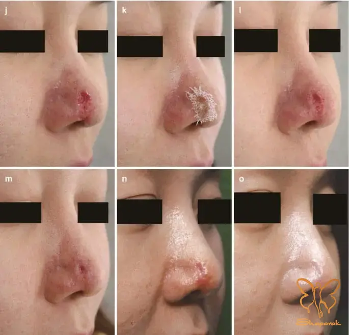 کلینیک شاپرک مشهد چرا مهارت پزشک در این نواحی حیاتی است کلینیک شاپرک مشهد چرا مهارت پزشک در این نواحی حیاتی است