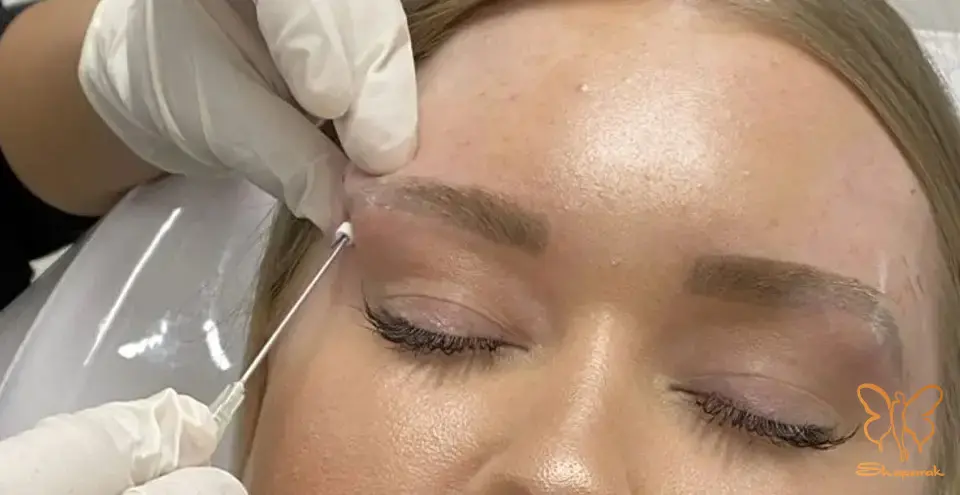 عدم ایجاد اسکار و جای زخم