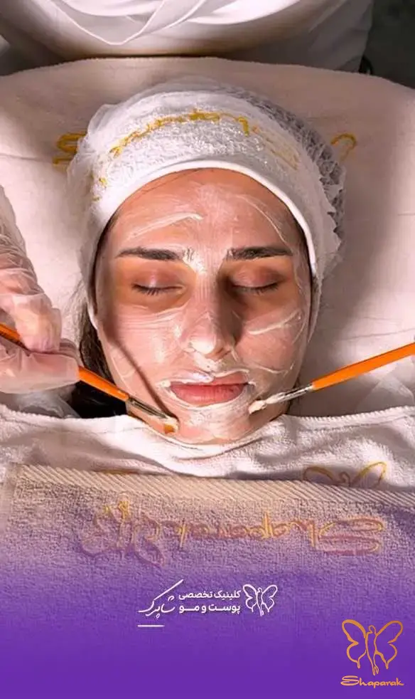 هیدرافیشال در مشهد  Hydrafacial