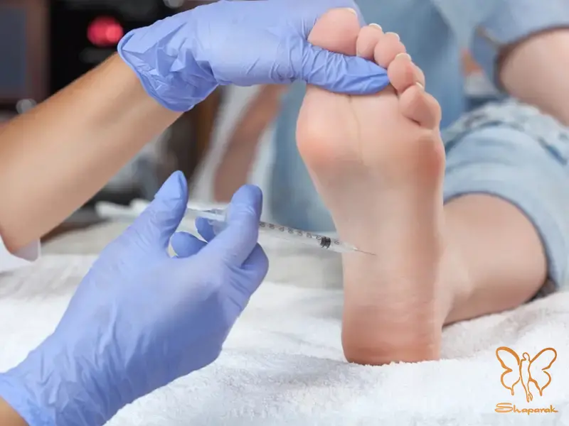 تزریق بوتاکس کف پا مشهد