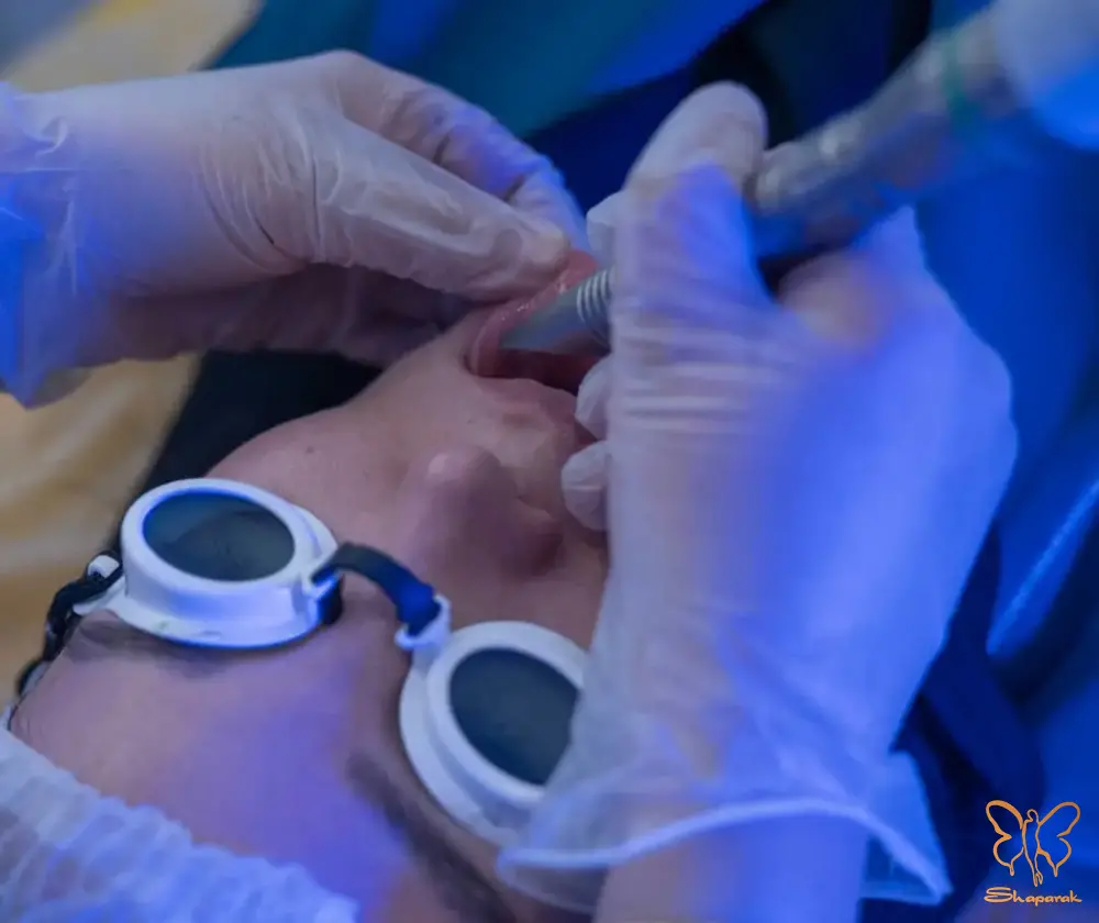 لیزر فوتونا فرکشنال در مشهد لیزر فوتونا فرکشنال در مشهد