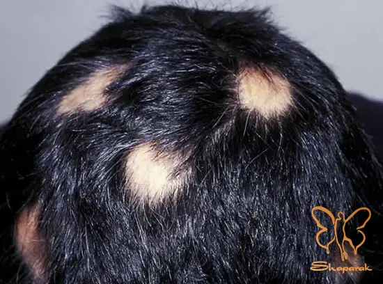 غیرفعال غیرفعال