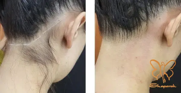  کلینیک تخصصی پوست و مو شاپرک طلایی مشهد